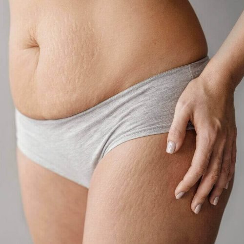 Enzimas para gordura locazalida em Bauru