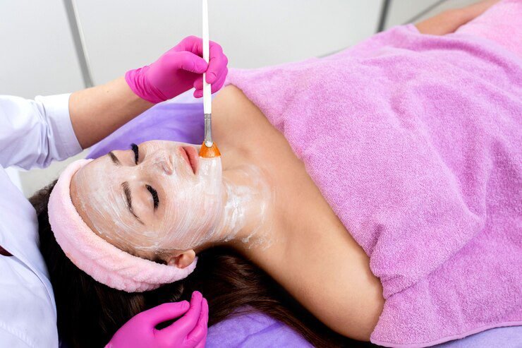 peeling químico em Bauru