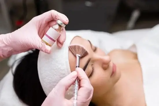 peeling químico em Bauru