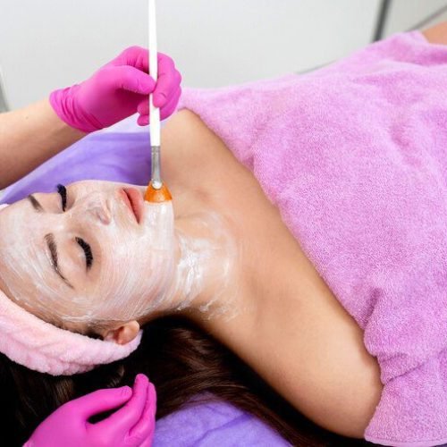 peeling químico em Bauru